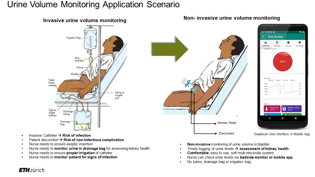Monitoring urinary bladder volume with selfsustaining "smart patch