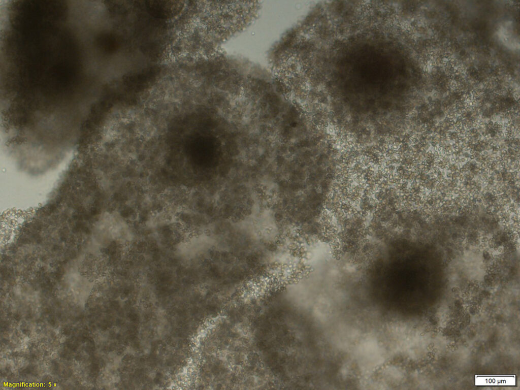 Oocytes from cattle surrounded by cumulus cells that support and nourish the oocytes.