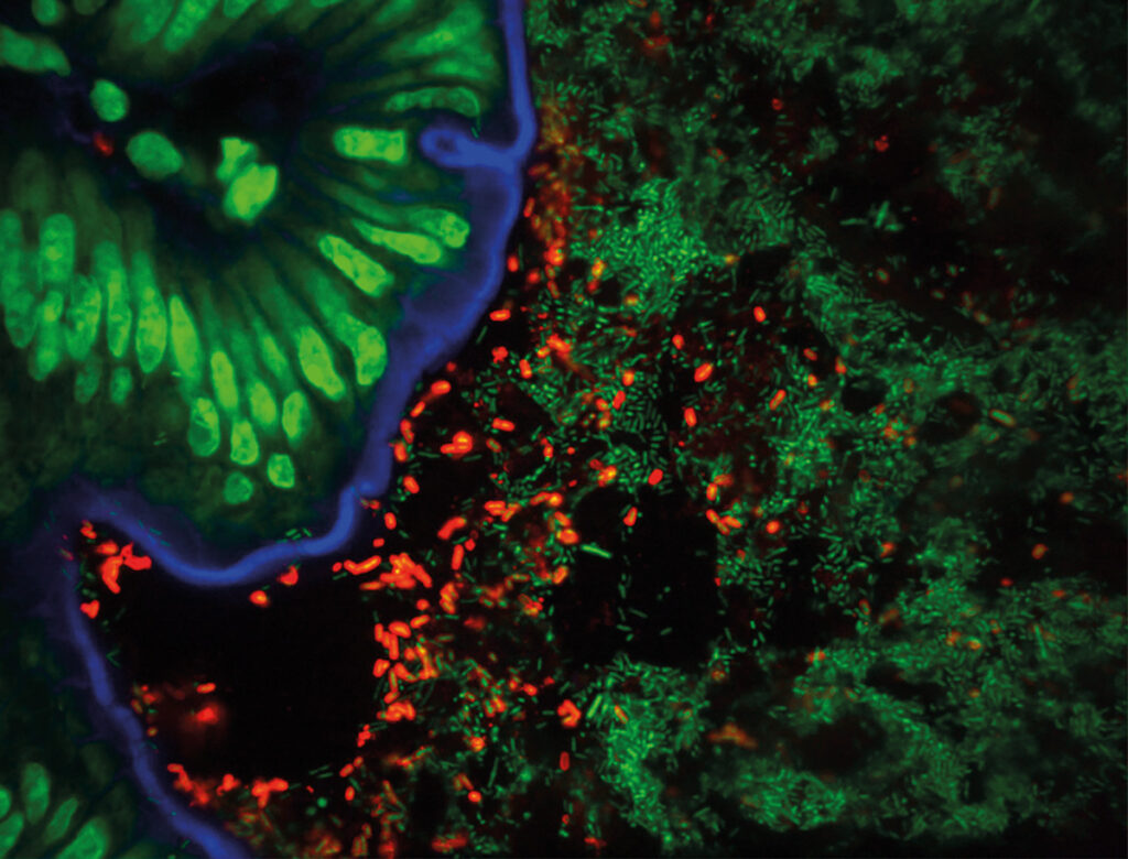Mouse intestine tissues (seen in blue) colonised by pathogenic Salmonella Typhimurium bacteria (red). The gut microbiota is seen in green (ref: Stecher et al. 2007, doi: 10.1371/journal.pbio.0050244). Courtesy of Wolf-Dietrich Hardt (ETH Zurich).